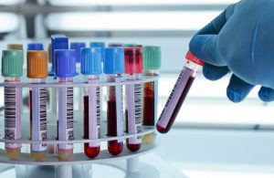 technician placing blood tubes in the laboratory centrifuge